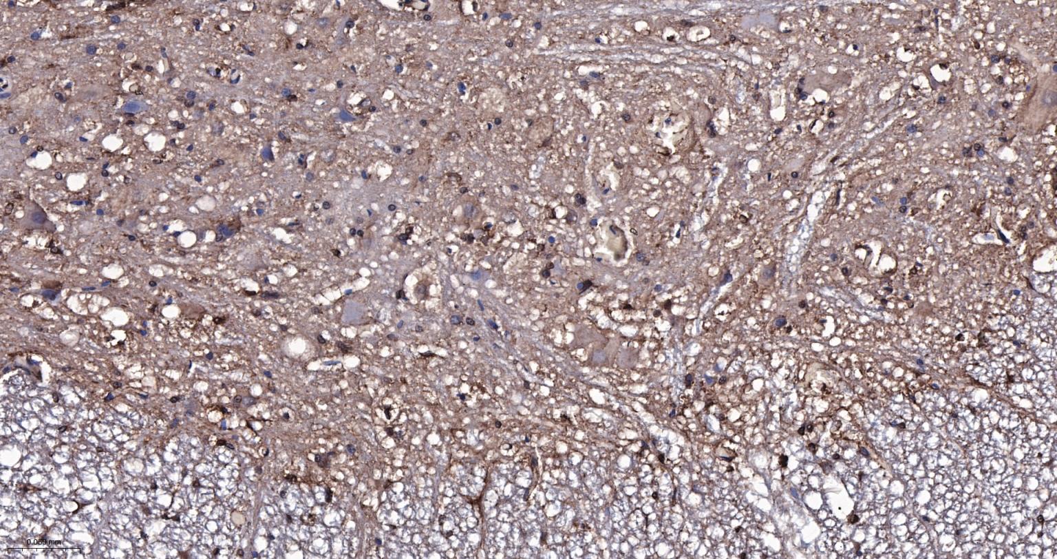 脑源神经营养因子重组兔单抗