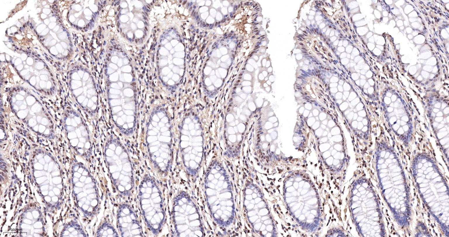 泛素蛋白(K48-linkage)重组兔单抗