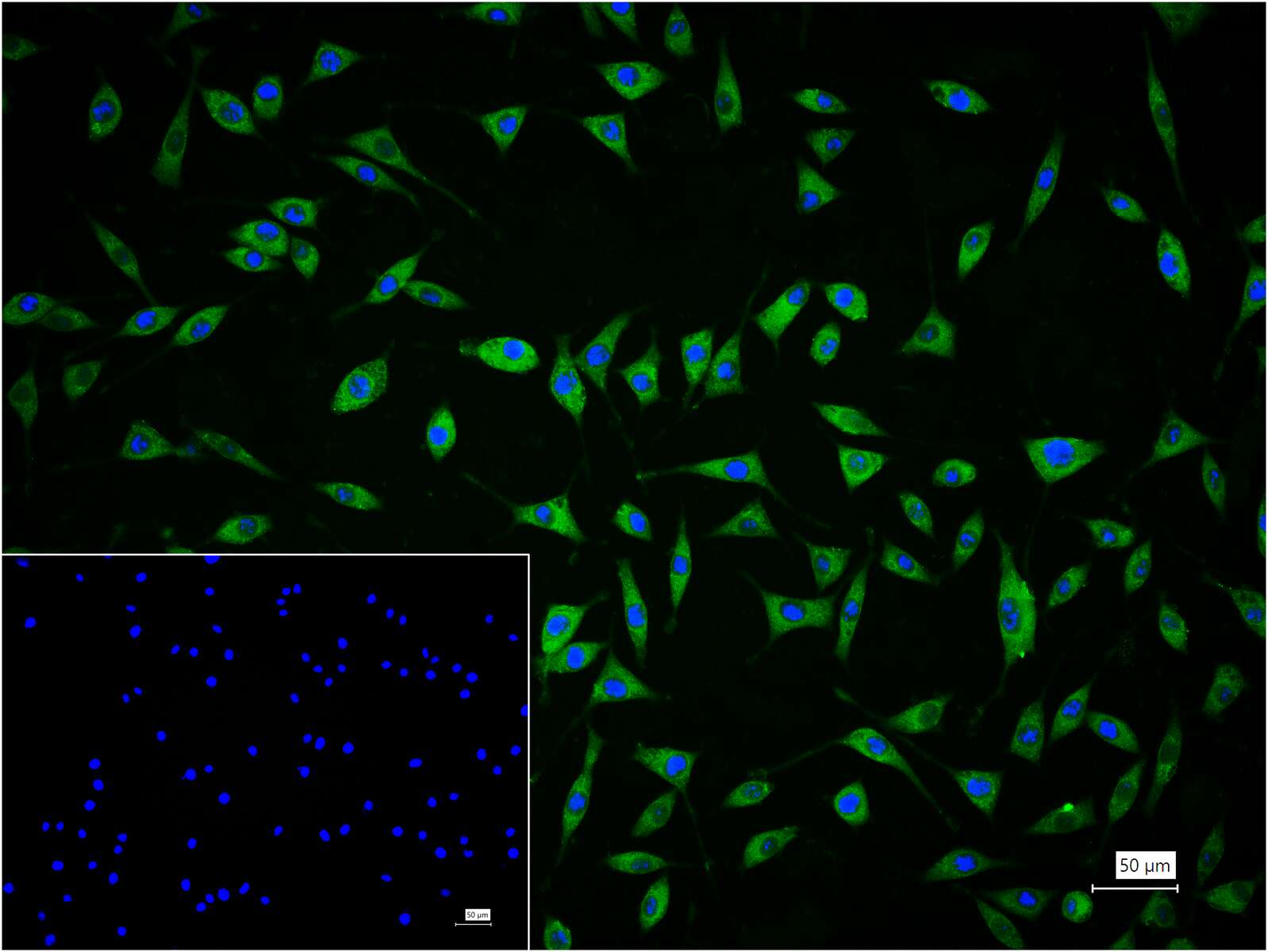 酪氨酸羟化酶兔单克隆抗体