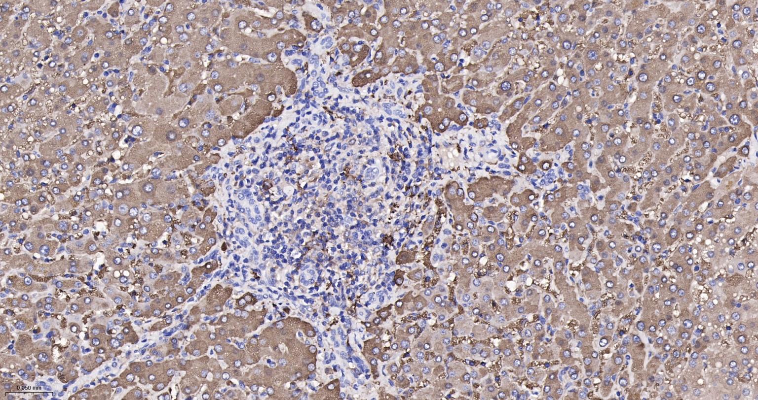 成纤维细胞生长因子21重组兔单抗