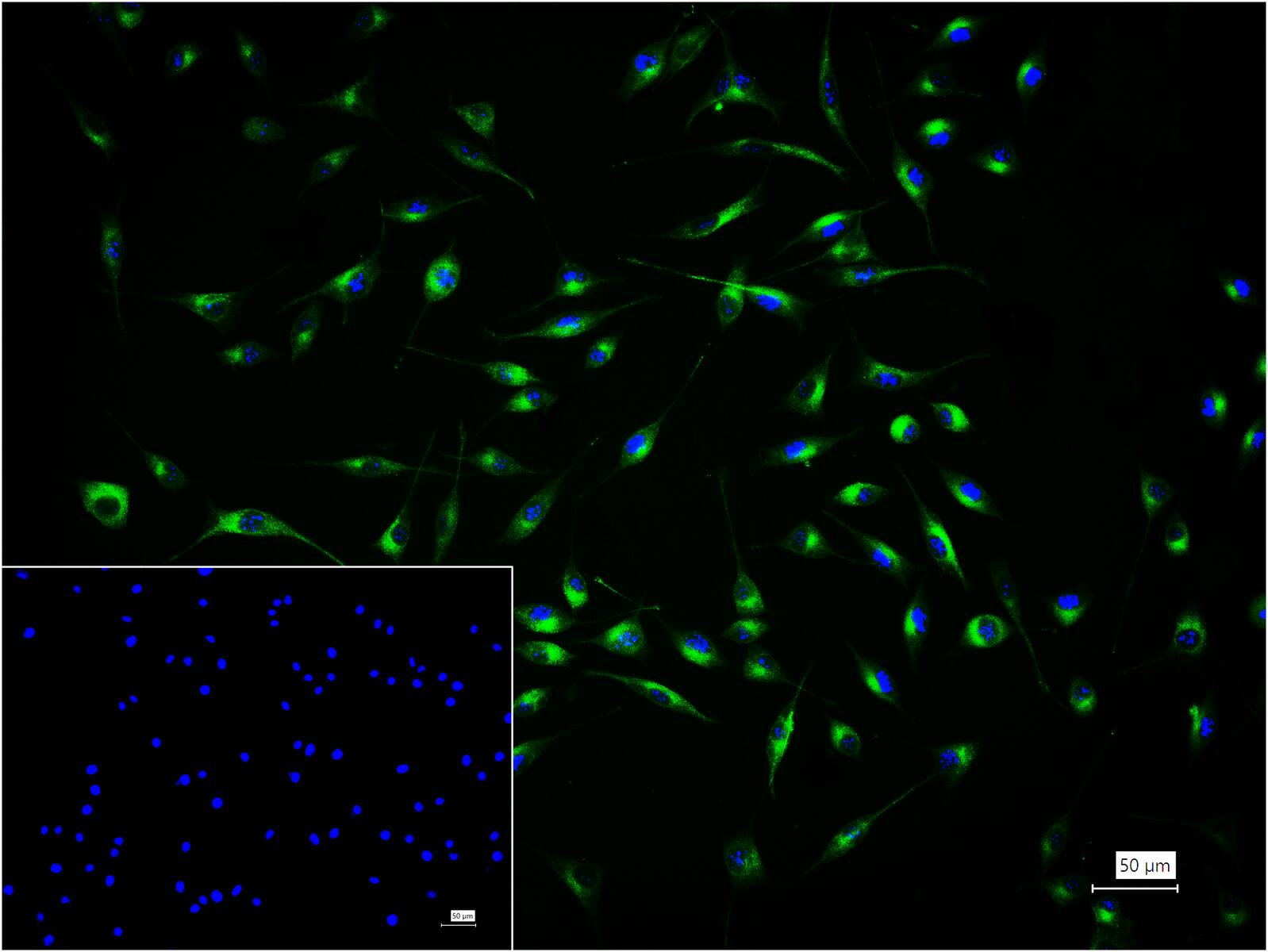 5-三磷酸肌醇受体1重组兔单抗