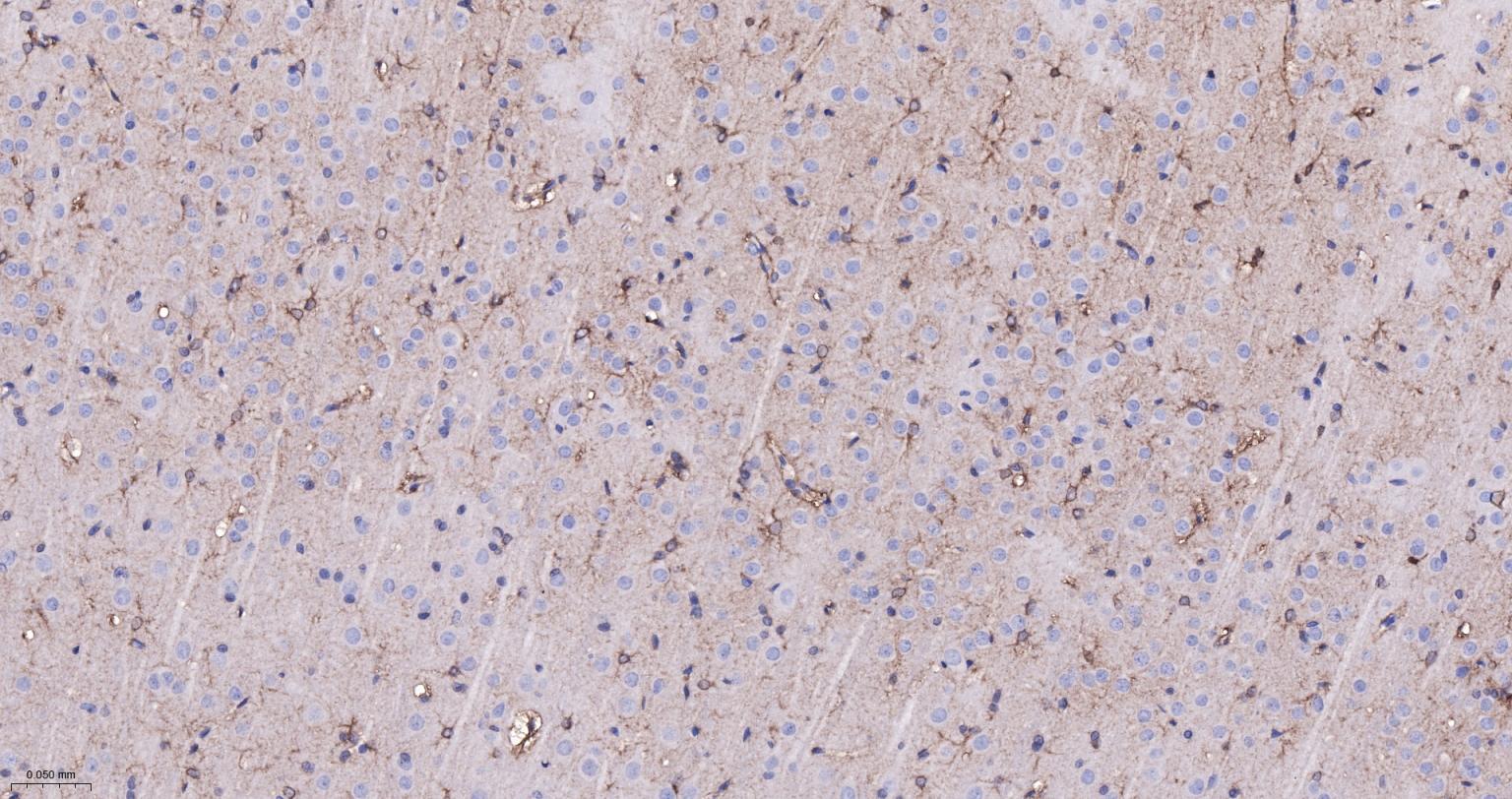 脑源神经营养因子重组兔单抗