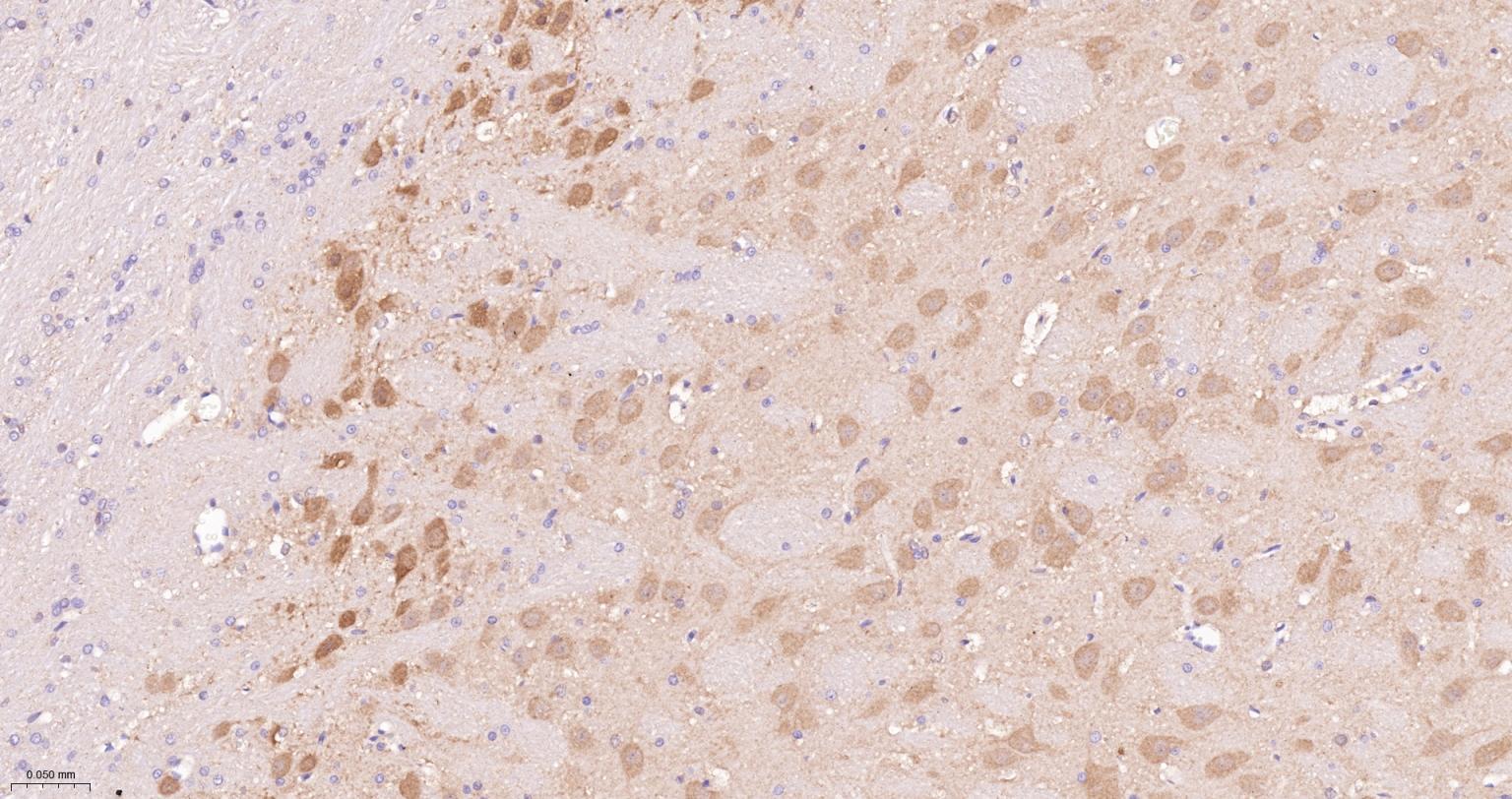 蛋白激酶B重组兔单抗