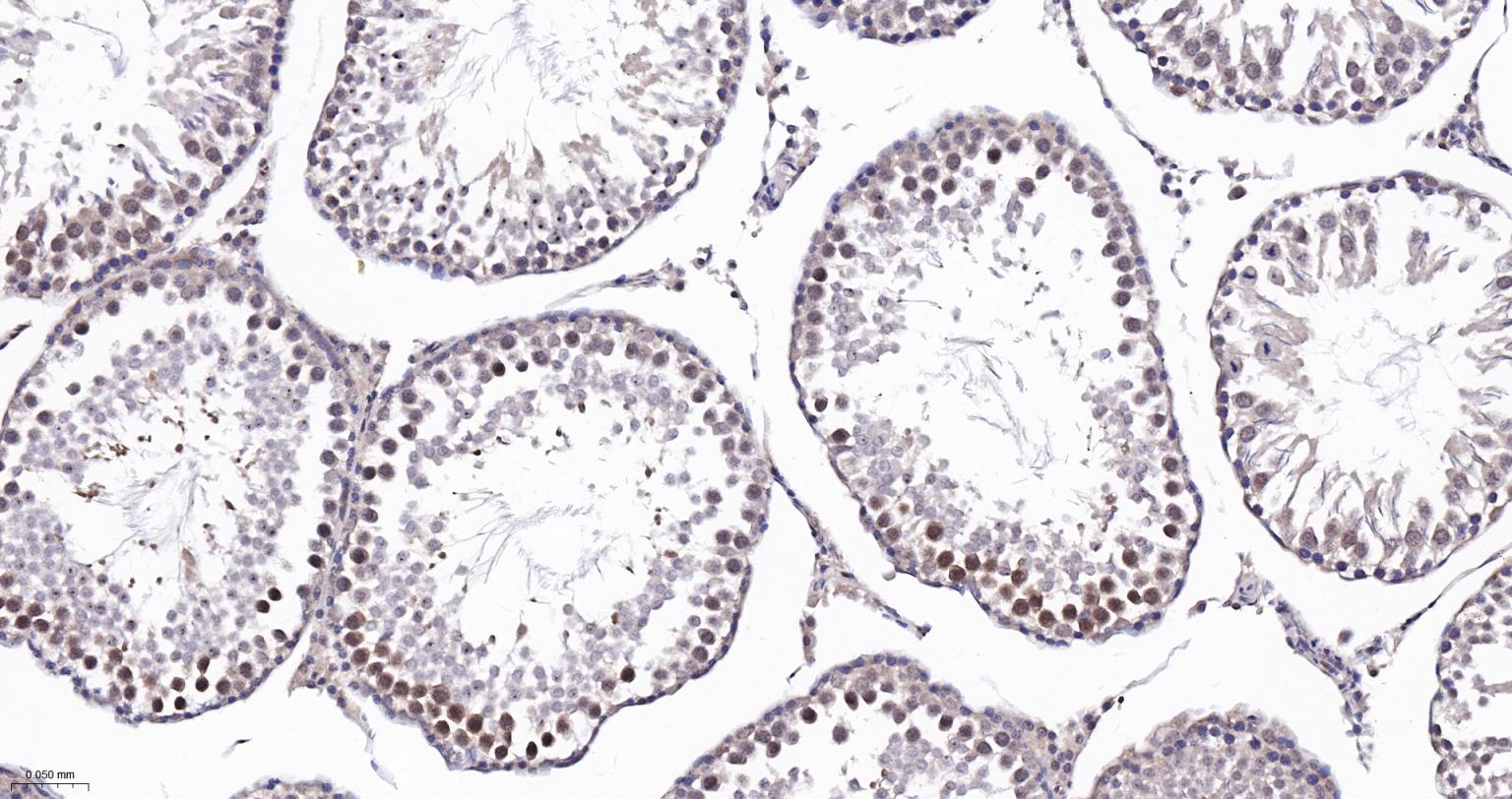 泛素蛋白(K48-linkage)重组兔单抗