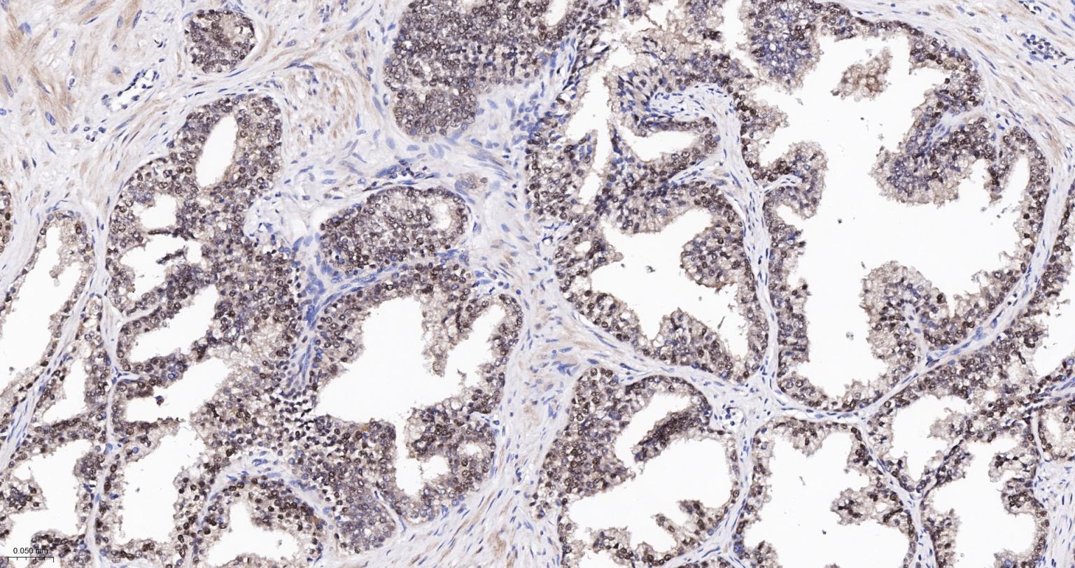 泛素蛋白(K48-linkage)重组兔单抗