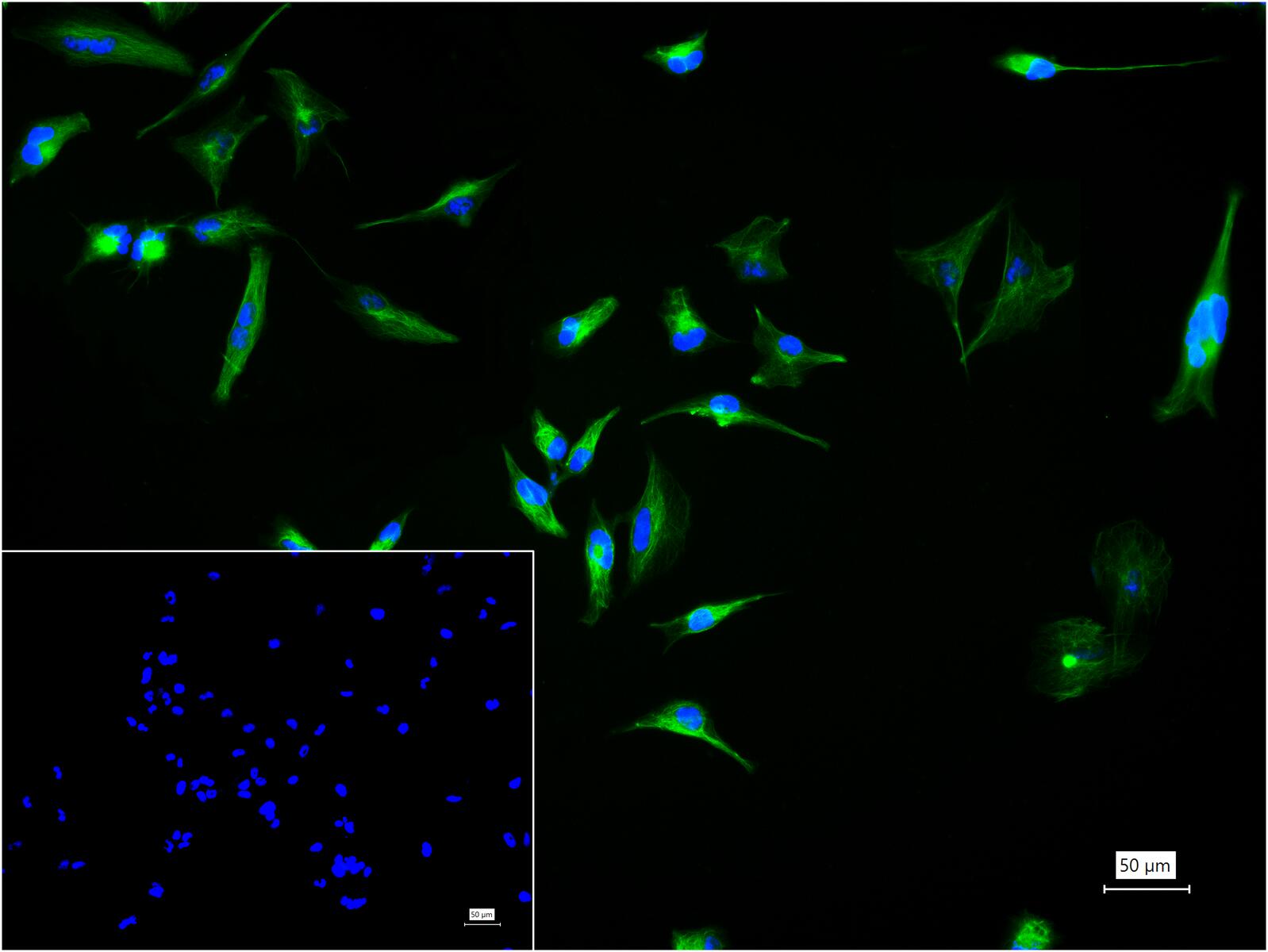 胶质纤维酸性蛋白抗体-bs-42001R