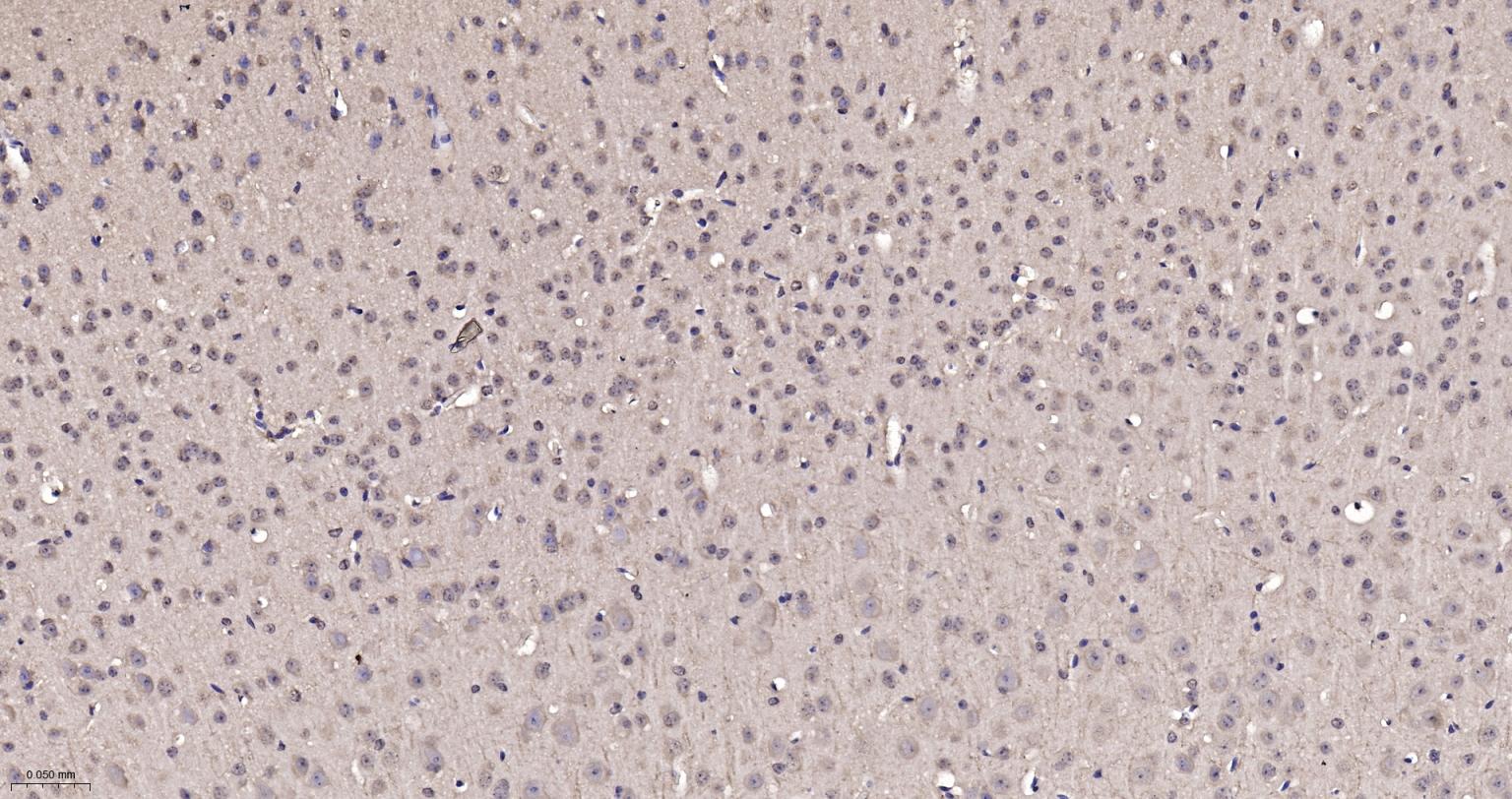 核输出蛋白5重组兔单抗-bsm-61945R