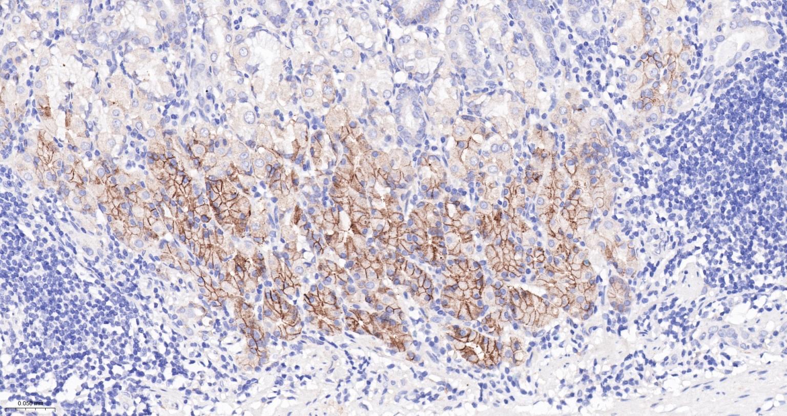 碳酸酐酶9重组兔单抗