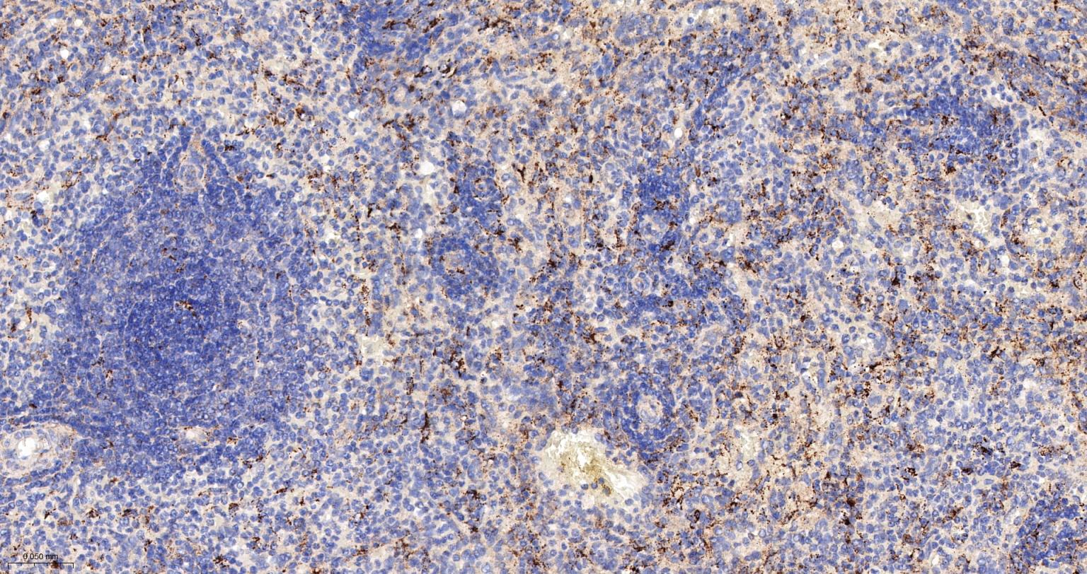 巨噬细胞克隆刺激因子重组兔单抗