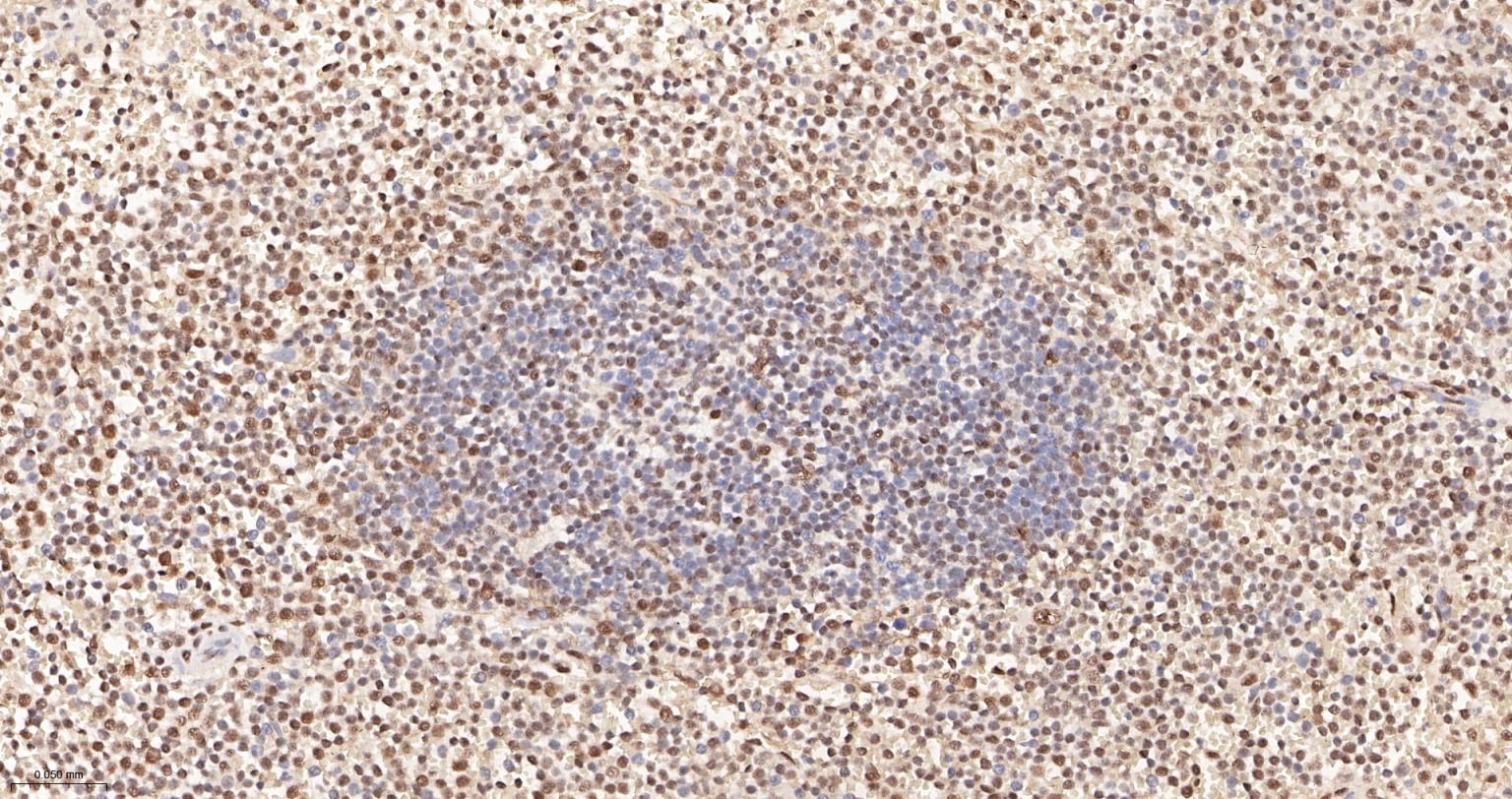 白细胞介素增强子结合因子2重组兔单抗