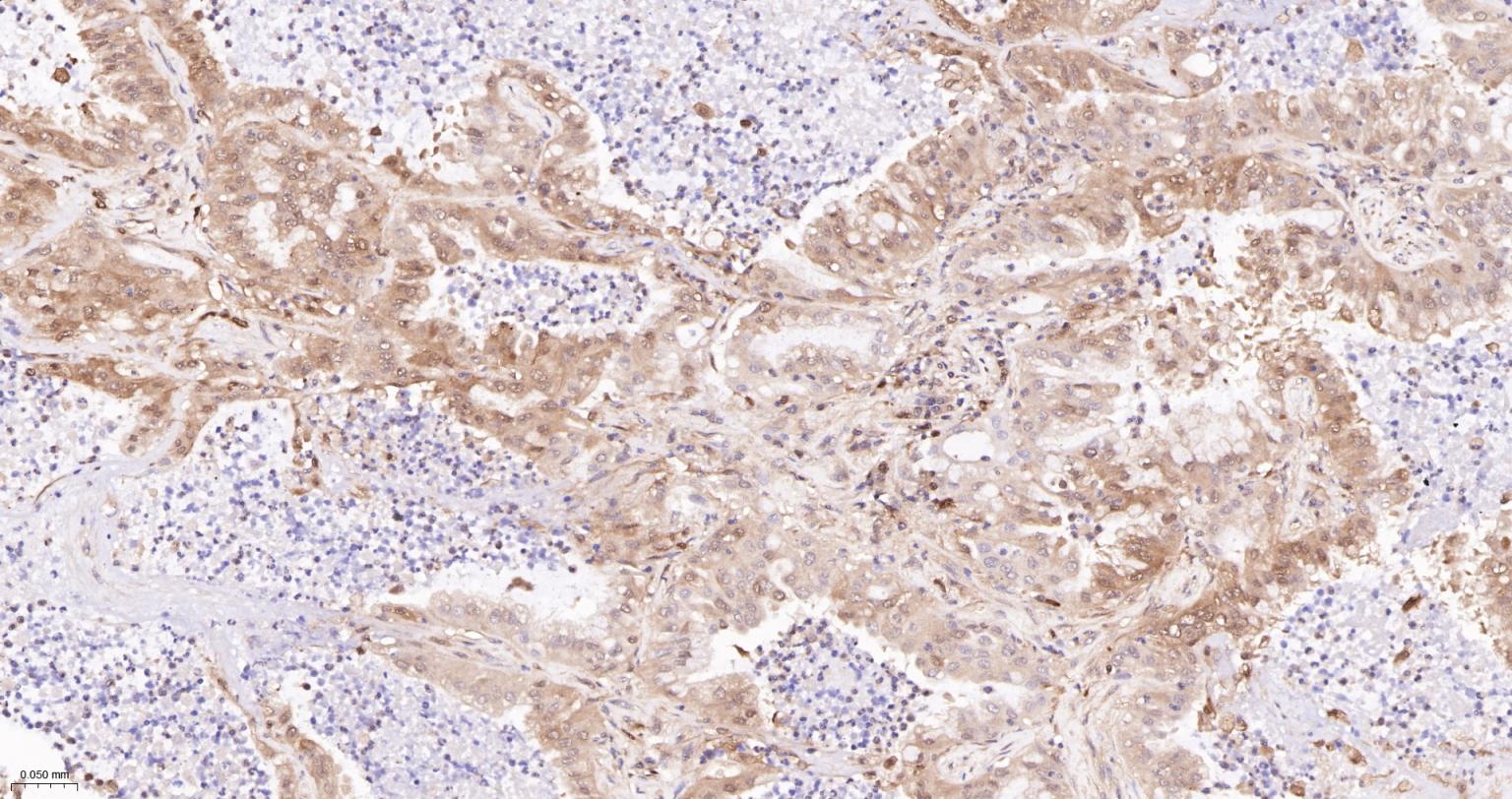谷胱甘肽过氧化酶4重组兔单抗