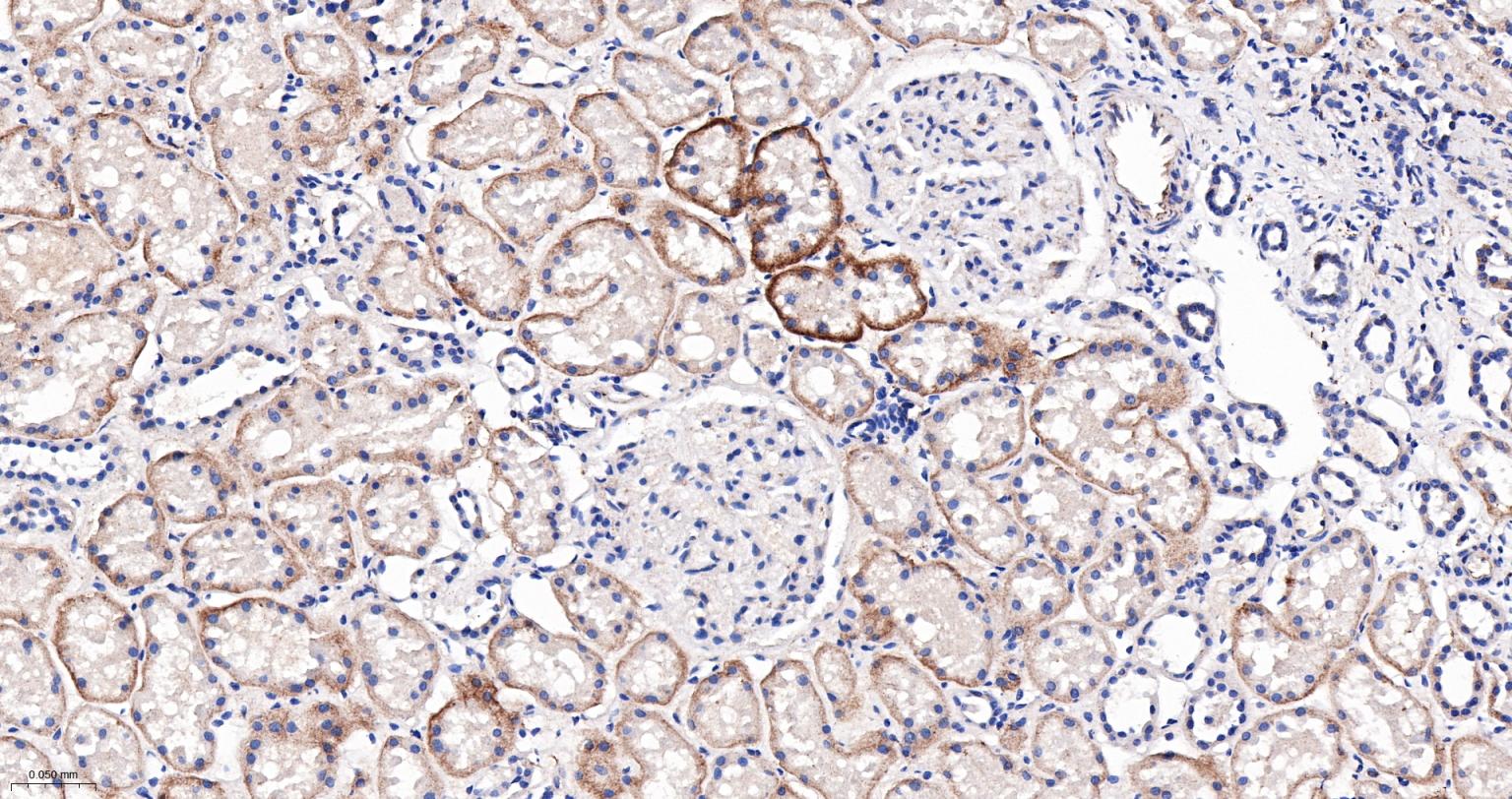 巨噬细胞克隆刺激因子重组兔单抗