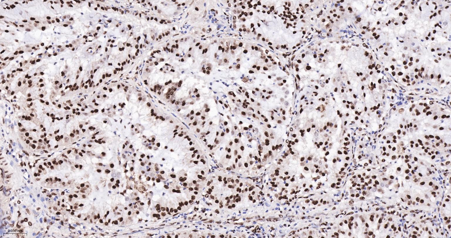白细胞介素增强子结合因子2重组兔单抗