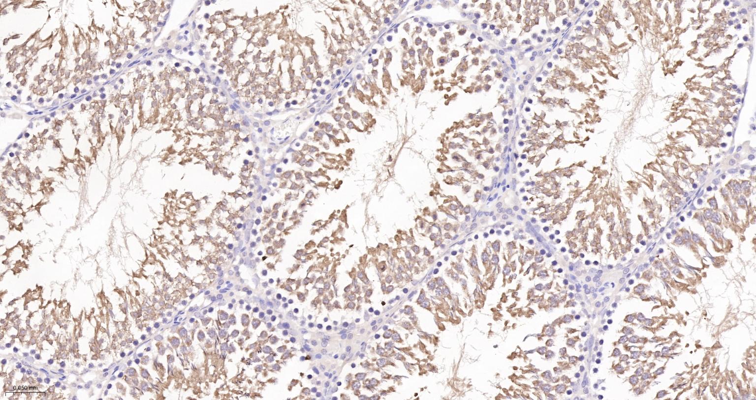 谷胱甘肽过氧化酶4重组兔单抗