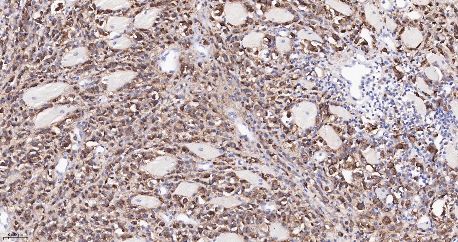 黑色素瘤相关抗原gp100重组兔单抗