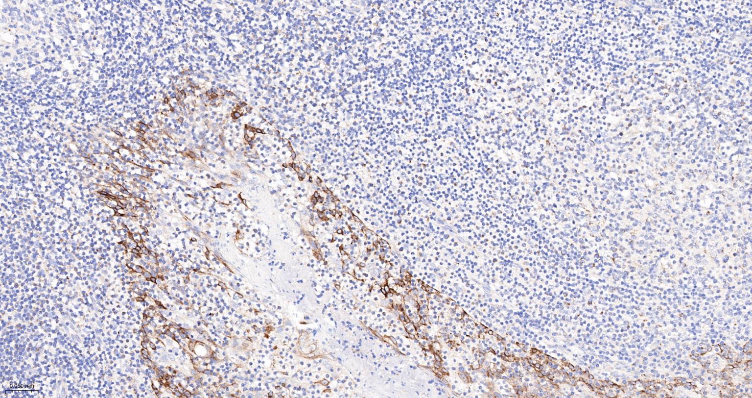 巨噬细胞克隆刺激因子重组兔单抗