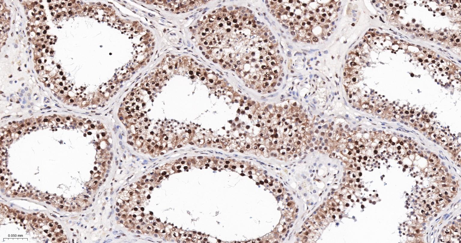 白细胞介素增强子结合因子2重组兔单抗