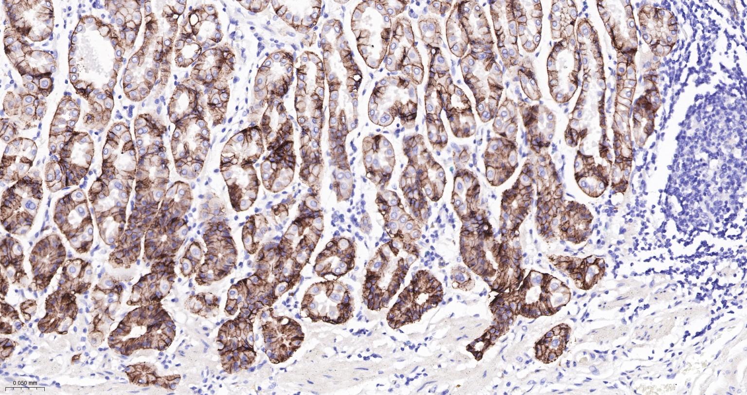 碳酸酐酶9重组兔单抗