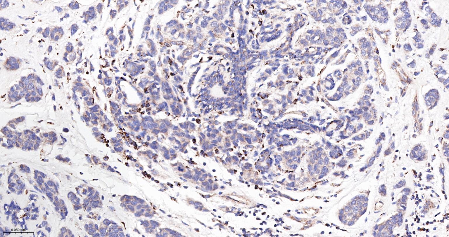 巨噬细胞克隆刺激因子重组兔单抗