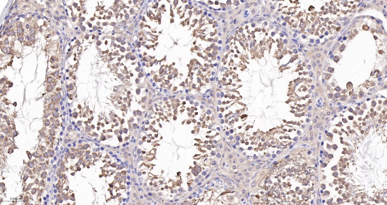 谷胱甘肽过氧化酶4重组兔单抗