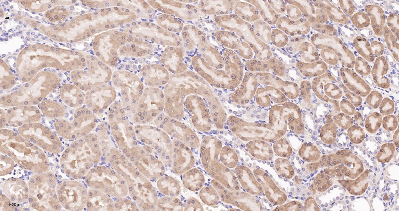 谷胱甘肽过氧化酶4重组兔单抗