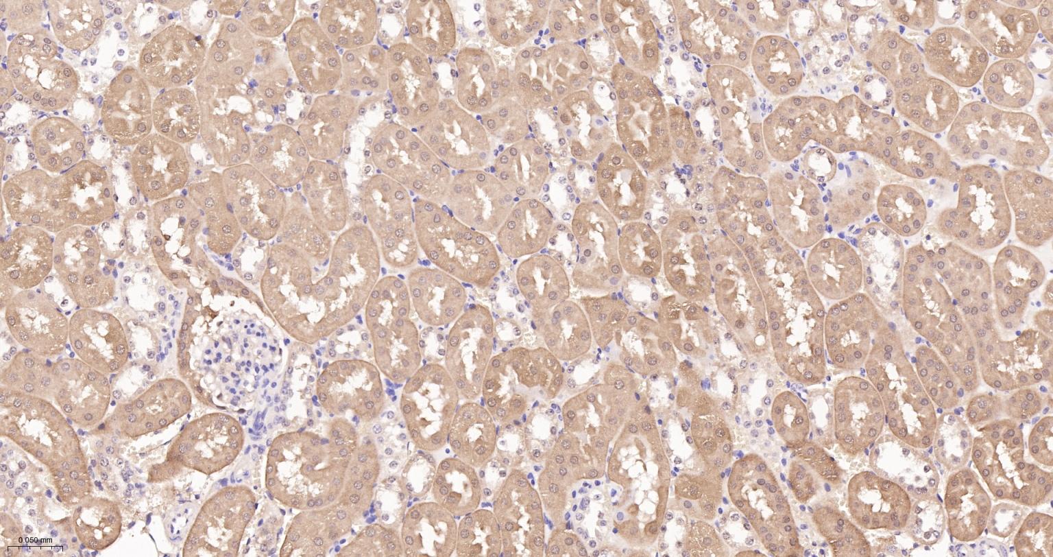 谷胱甘肽过氧化酶4重组兔单抗
