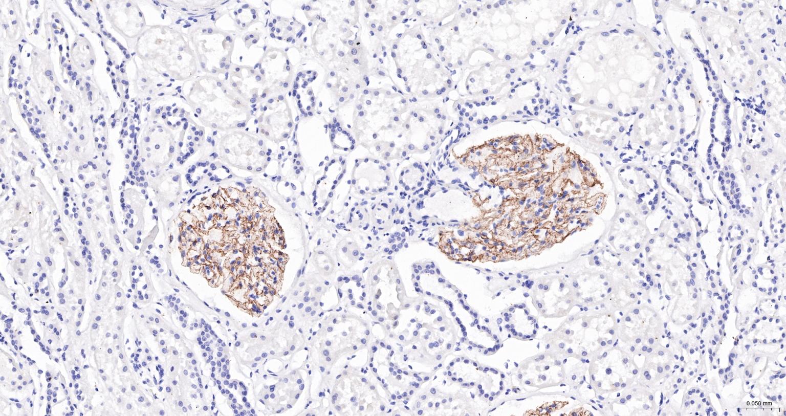 Nephrin Mouse mAb (一抗) - IHC-P,IHC-F,IF | Bioss