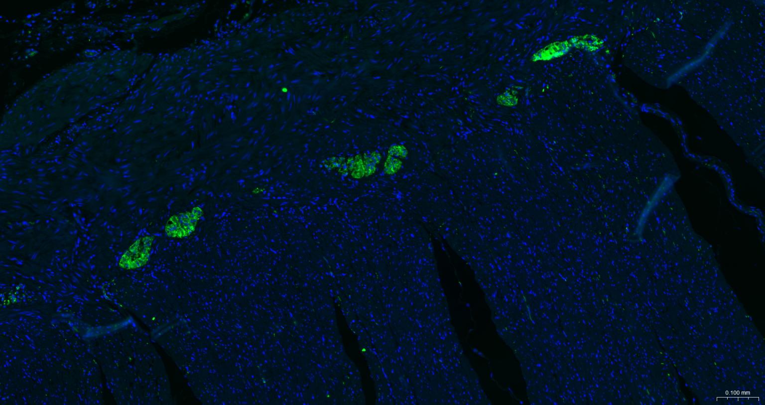 神经细胞胞浆蛋白9.5/蛋白基因产物9.5单克隆抗体-bsm-41257M