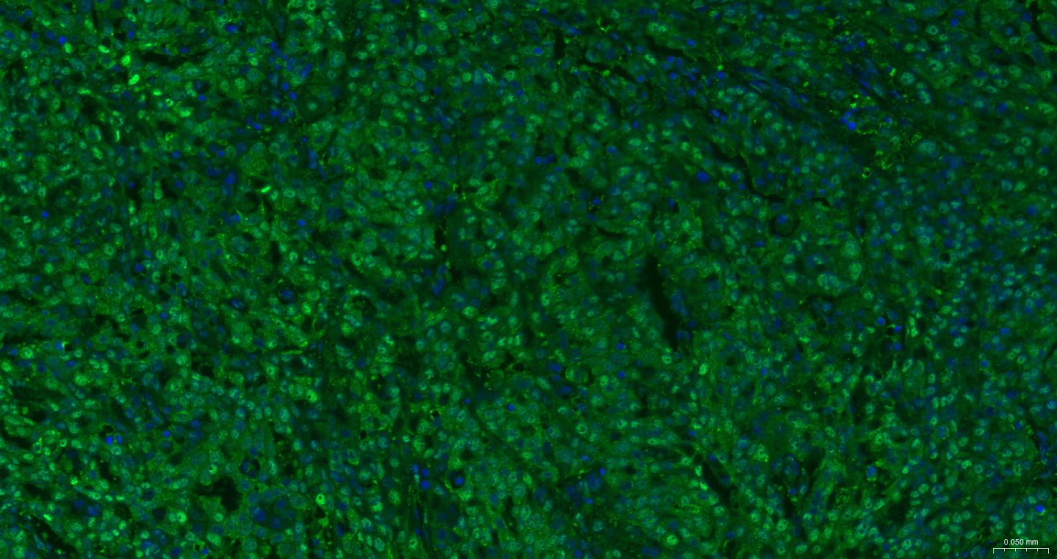 泛素激活酶E1重组兔单抗