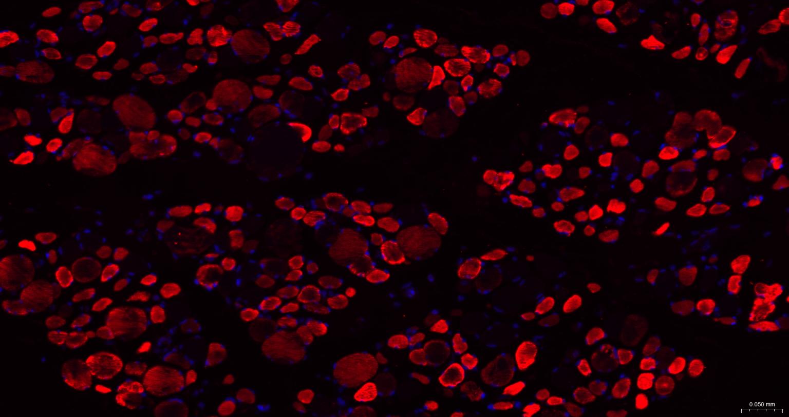 早老素γ分泌酶2重组兔单抗-bsm-61979R