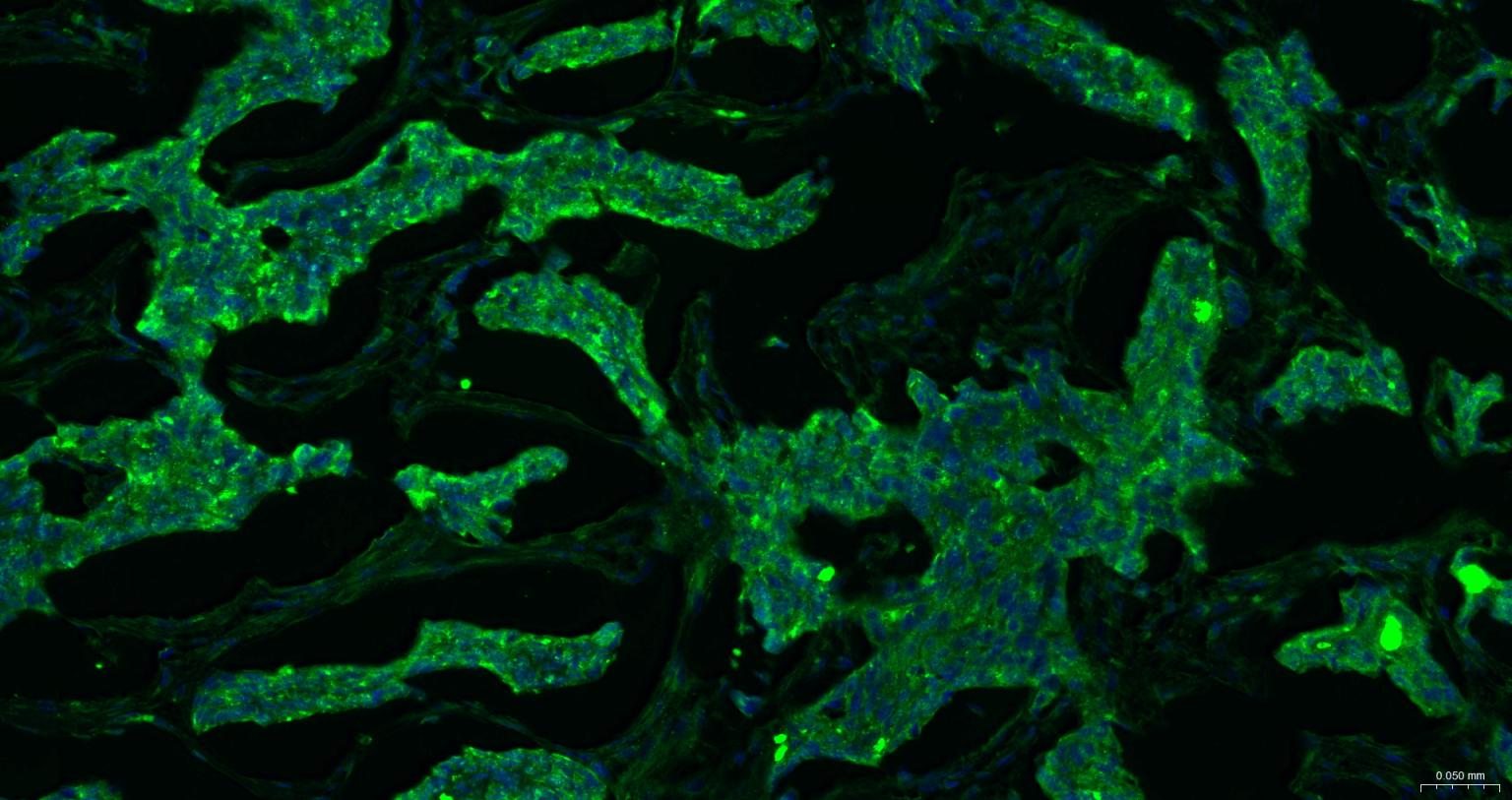 磷脂酰乙醇胺结合蛋白1重组兔单抗-bsm-61243R