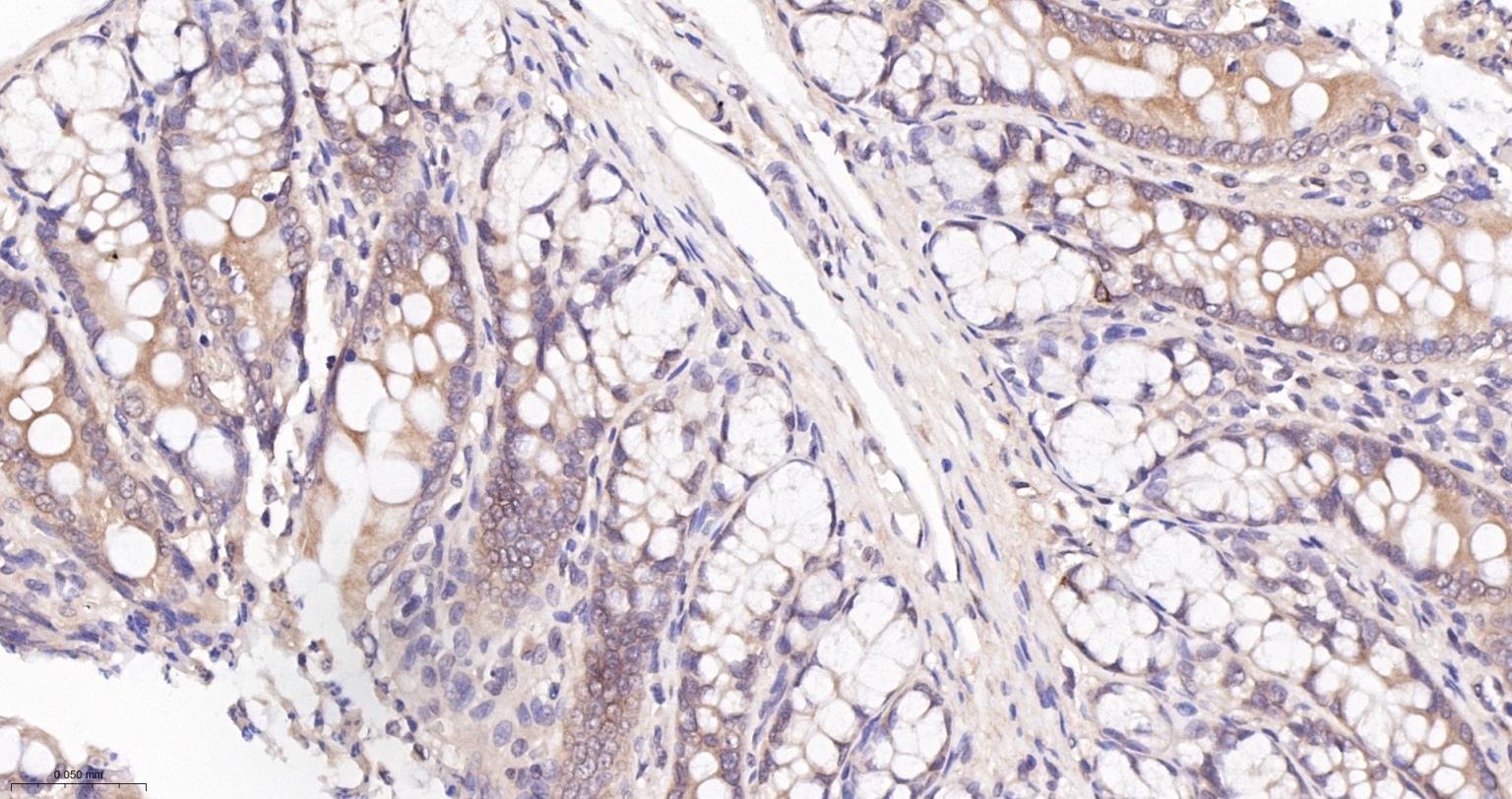 谷胱甘肽过氧化酶4重组兔单抗