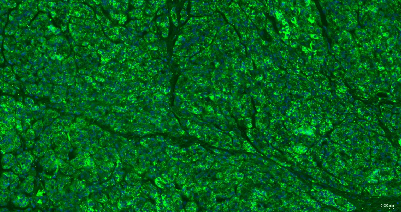帕金蛋白重组兔单抗