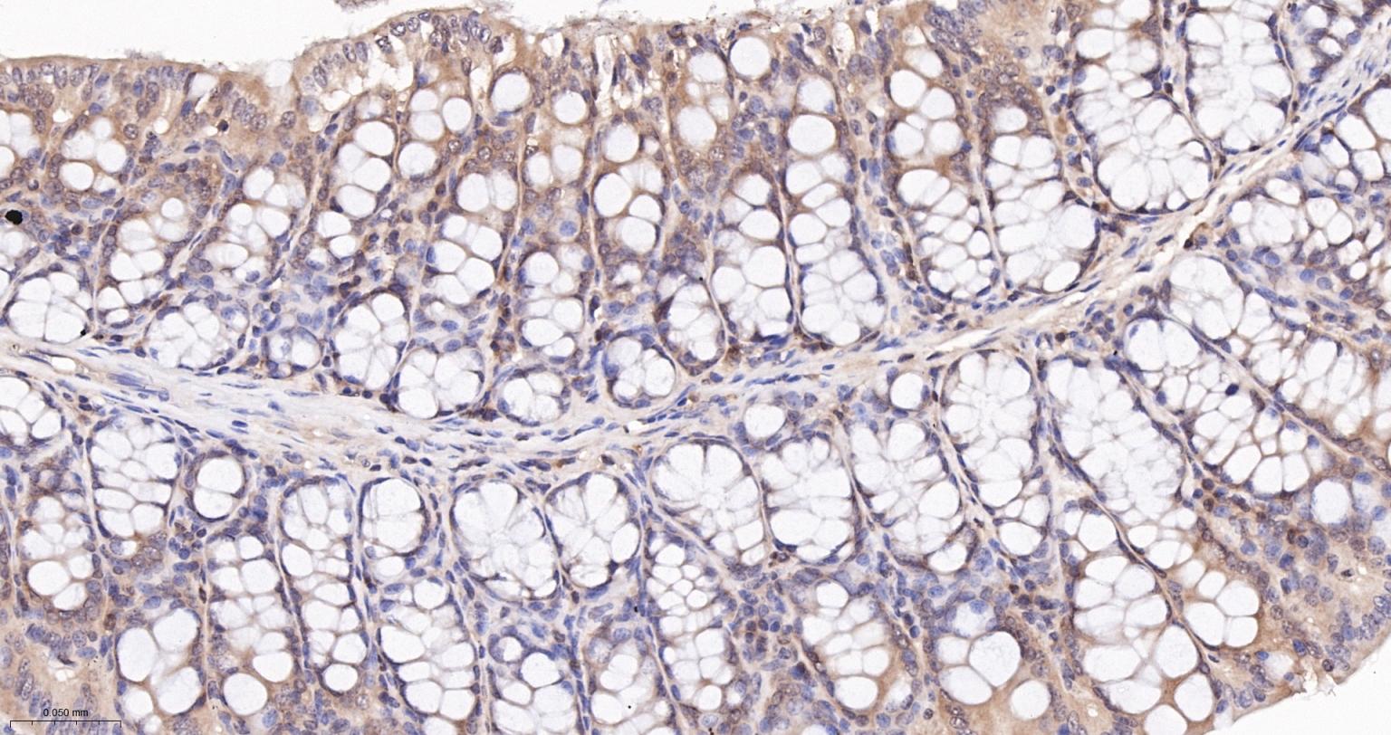 谷胱甘肽过氧化酶4重组兔单抗