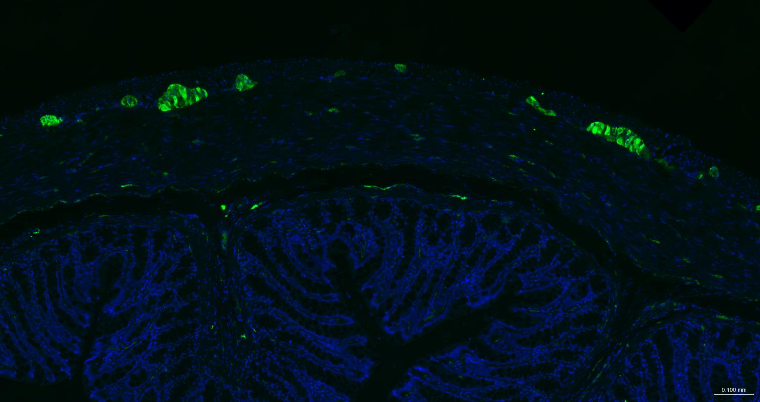 神经细胞胞浆蛋白9.5/蛋白基因产物9.5单克隆抗体-bsm-41257M