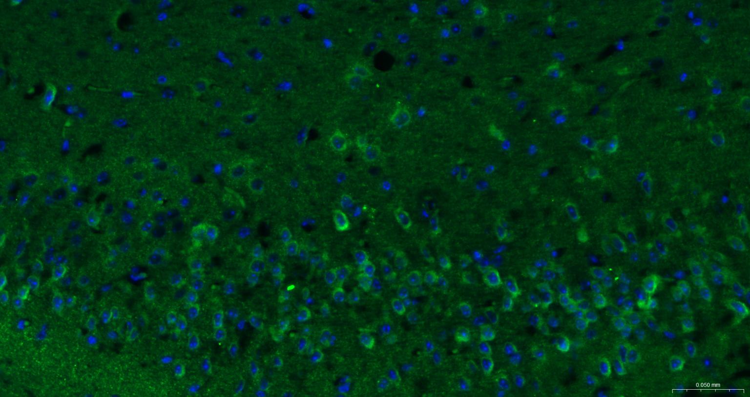G蛋白结合蛋白RAB10抗体-bs-11257R