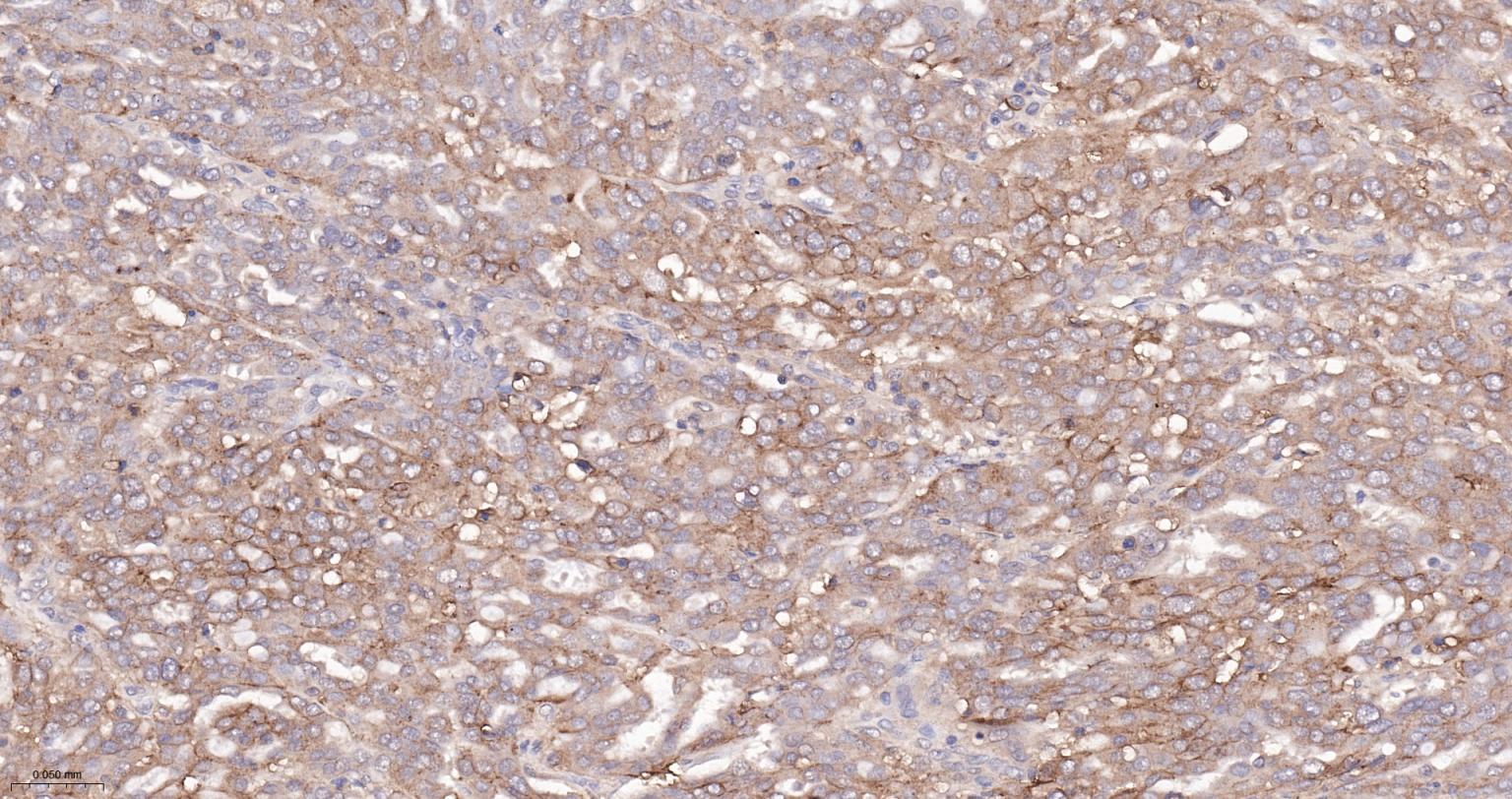 转铁蛋白受体（CD71）抗体