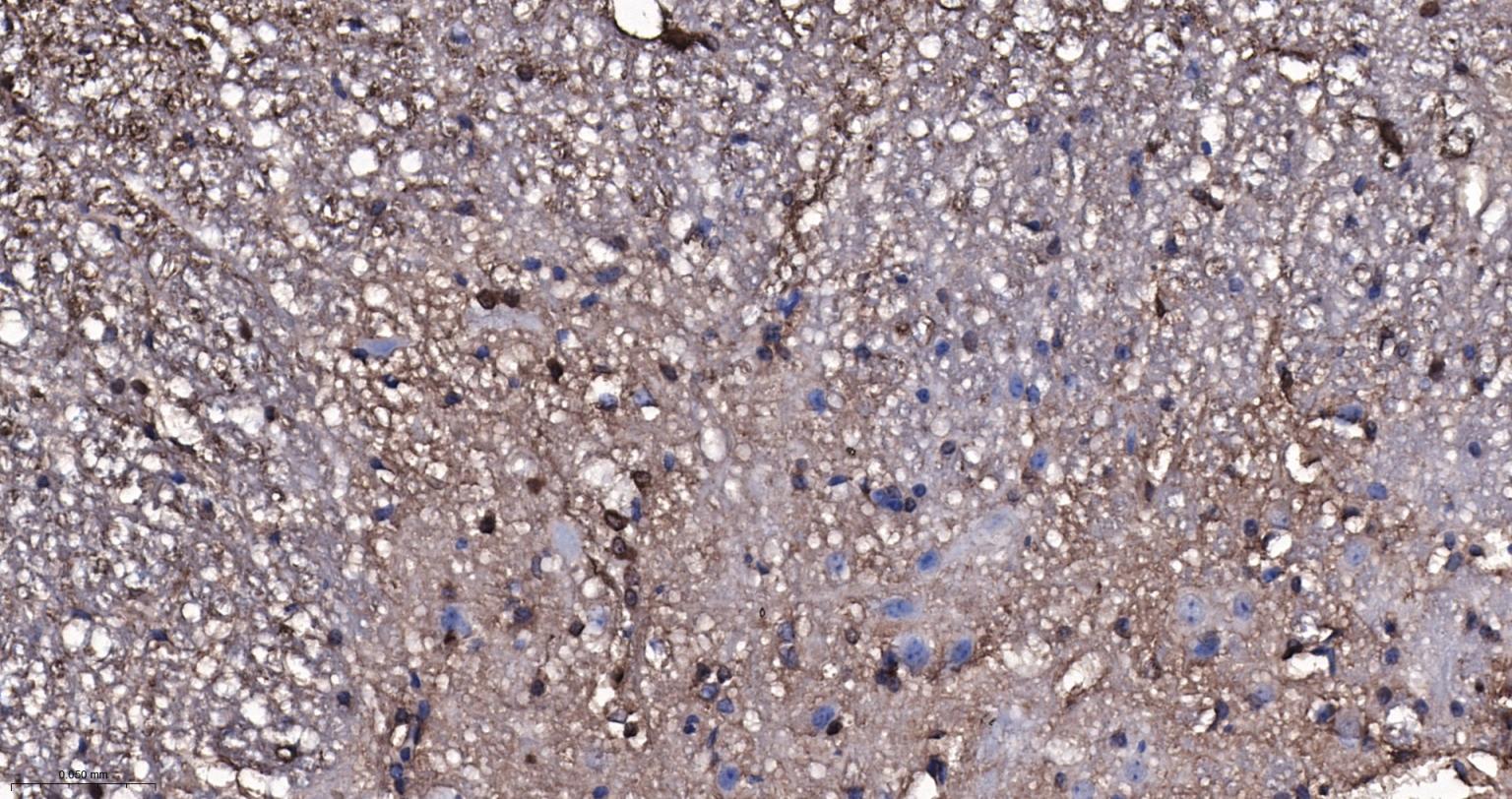 脑源神经营养因子重组兔单抗