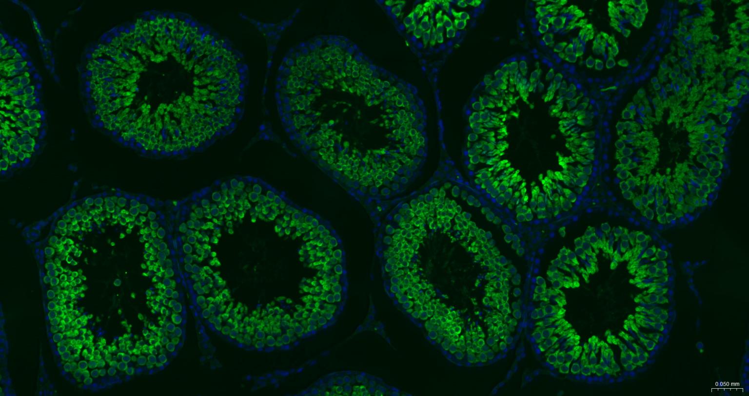 热休克蛋白-70重组兔单抗