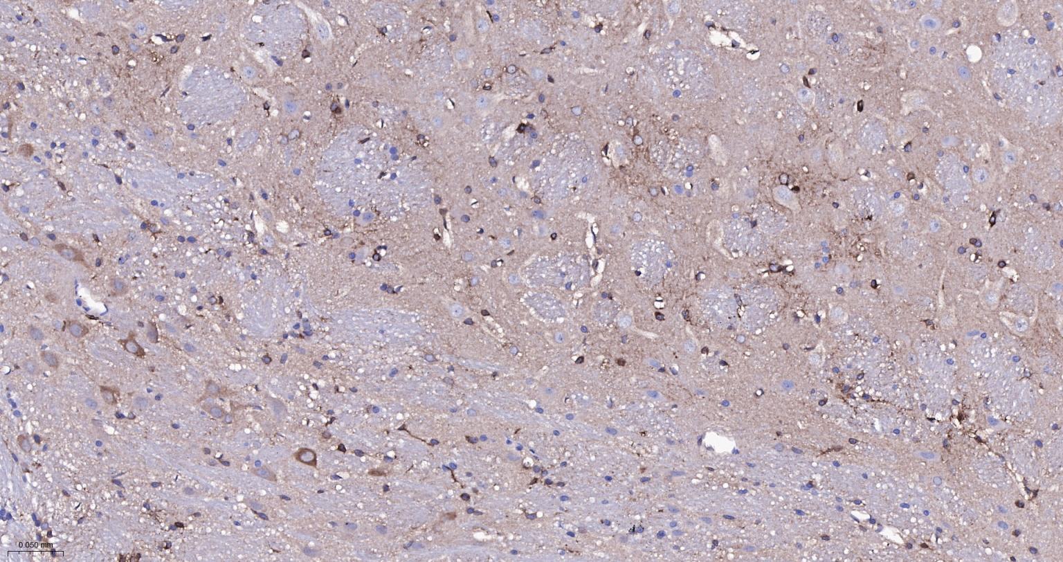 成纤维细胞生长因子21重组兔单抗