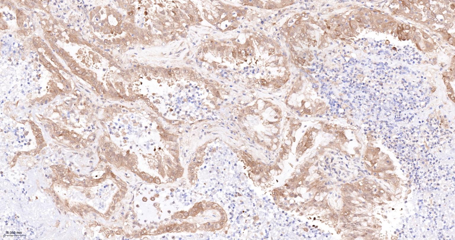 转铁蛋白受体（CD71）抗体