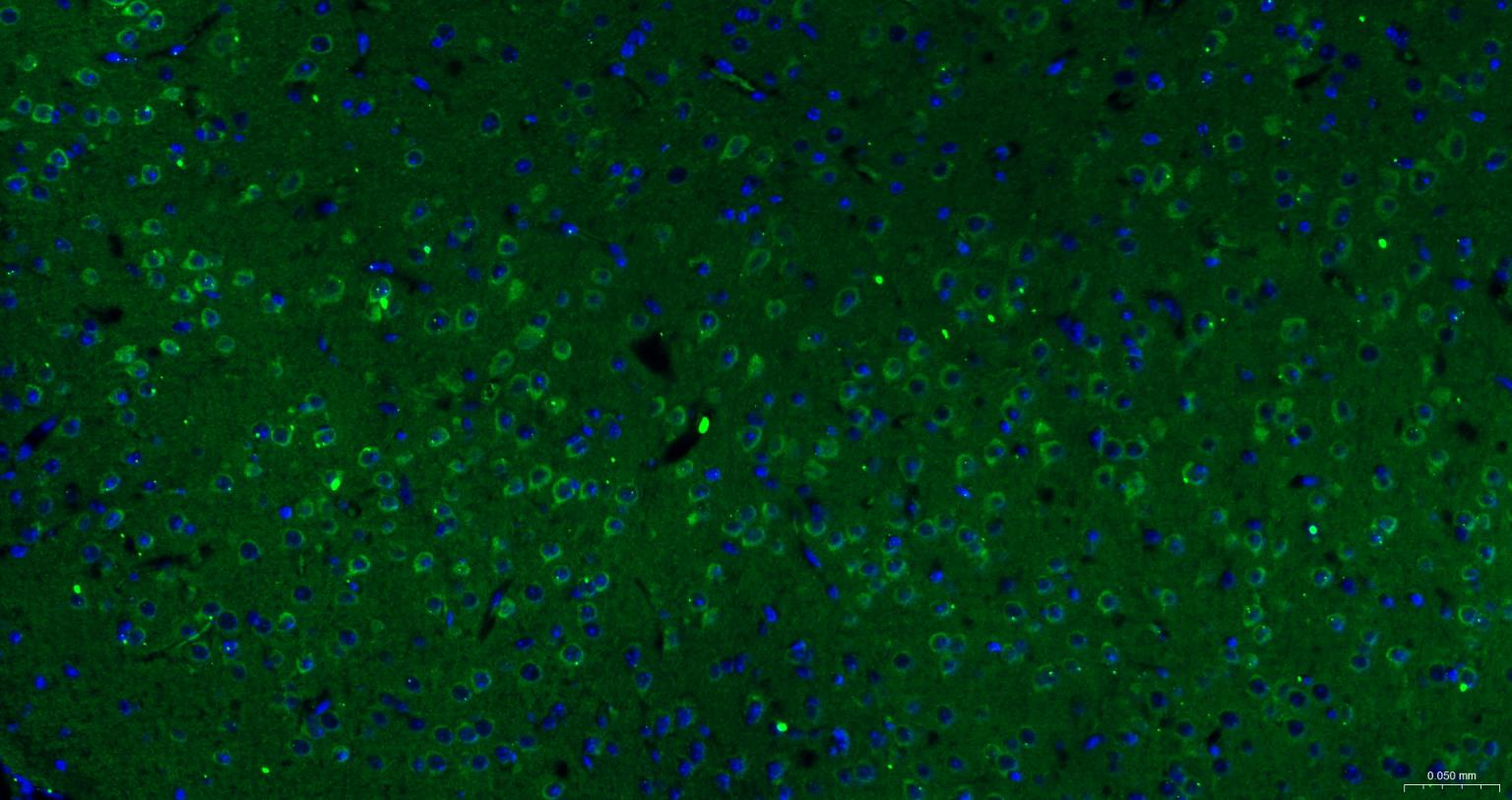 一种肿瘤抑制基因抗体