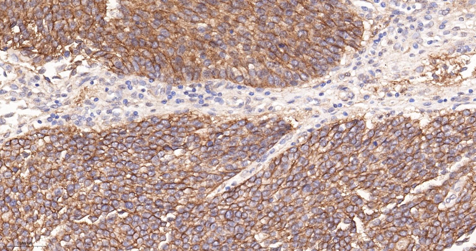 上皮特异性抗原（CD326）重组兔单克隆抗体