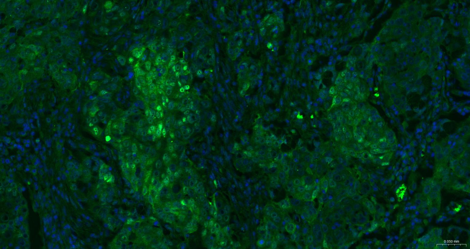 热休克蛋白-70重组兔单抗