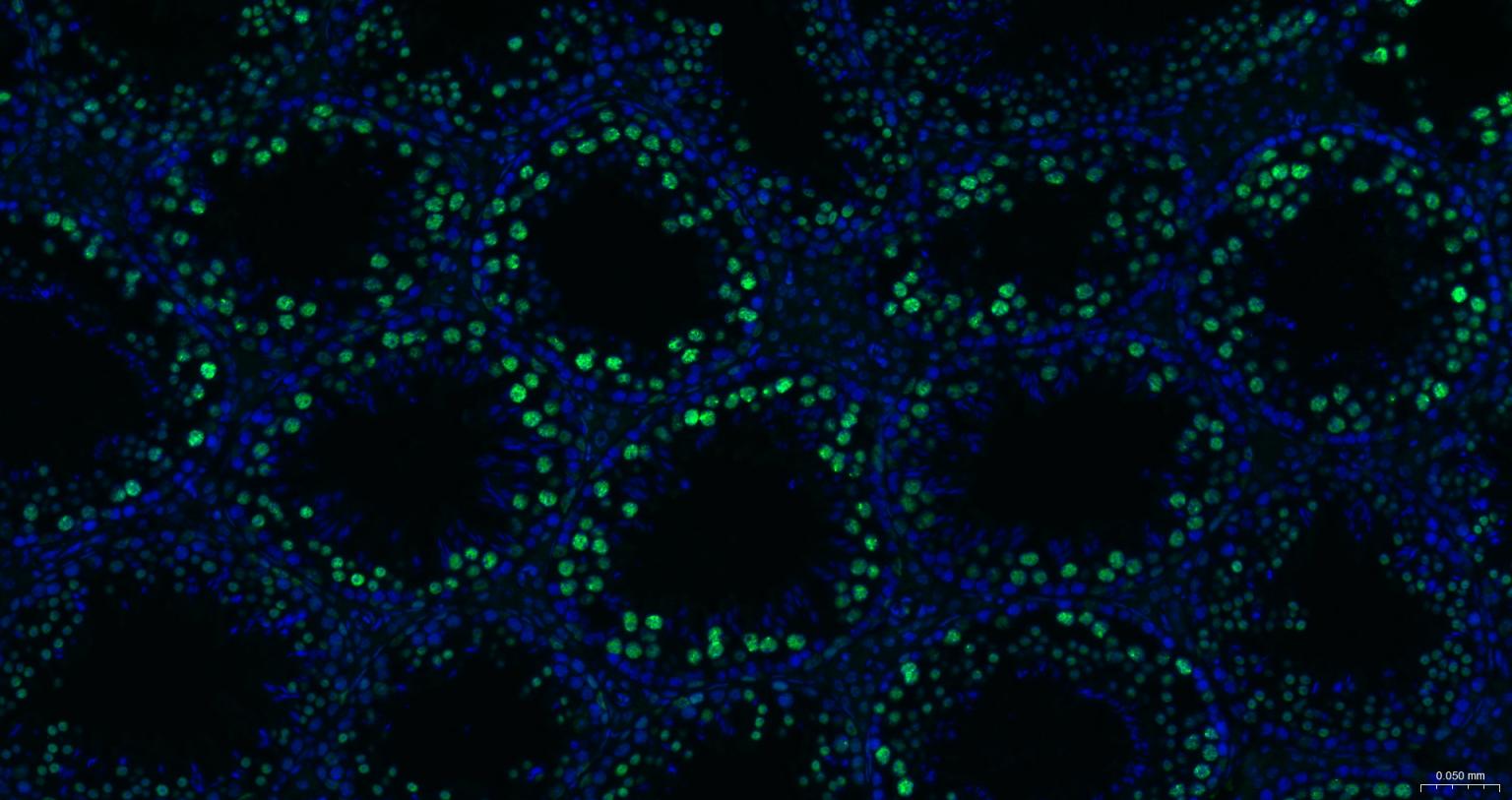组蛋白去乙酰化酶1（核内参）重组兔单抗
