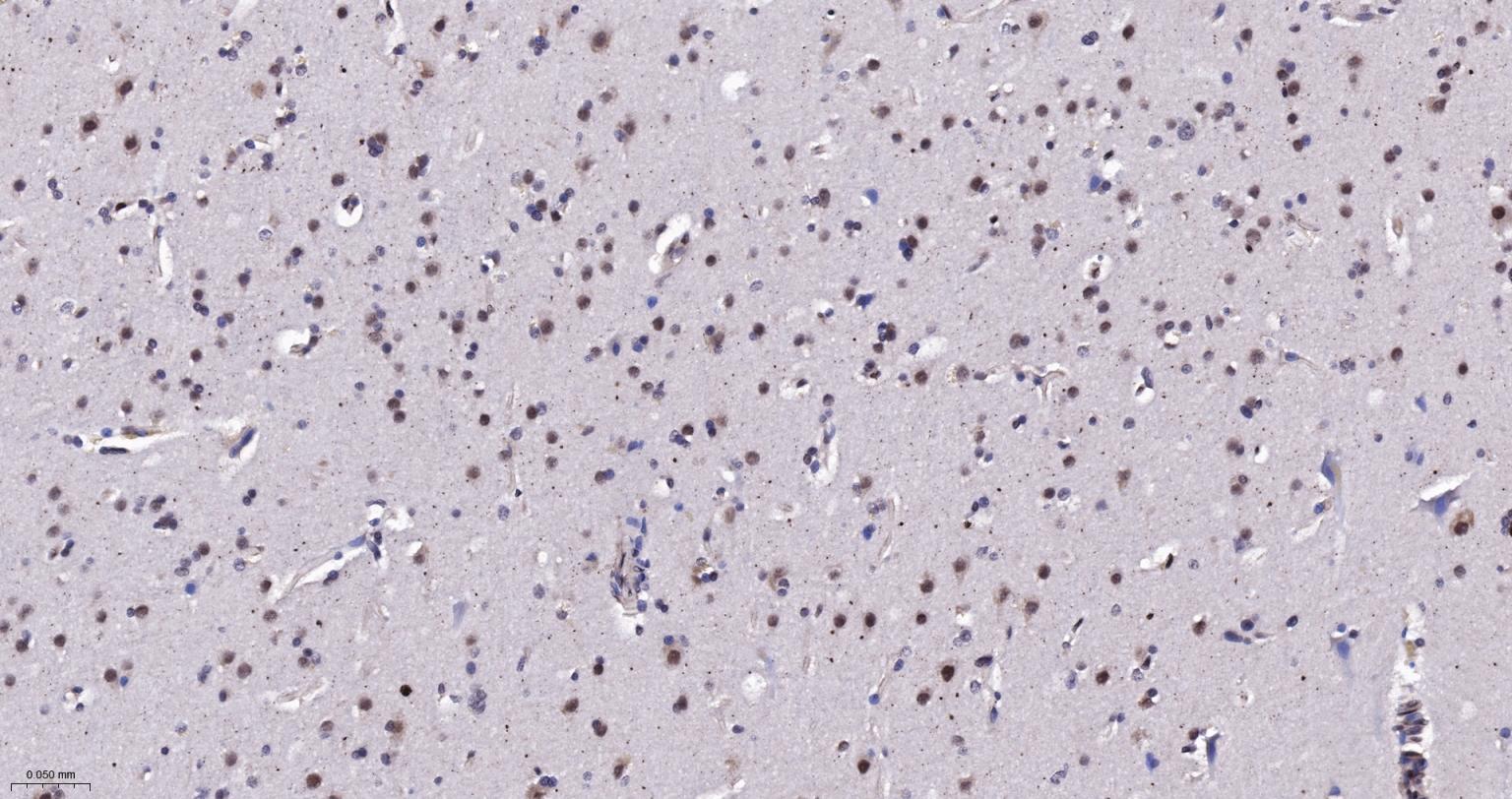 泛素蛋白(K48-linkage)重组兔单抗