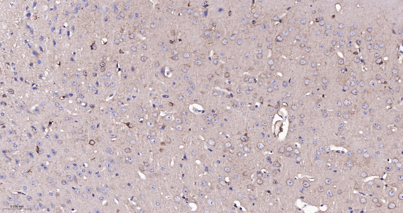 成纤维细胞生长因子21重组兔单抗