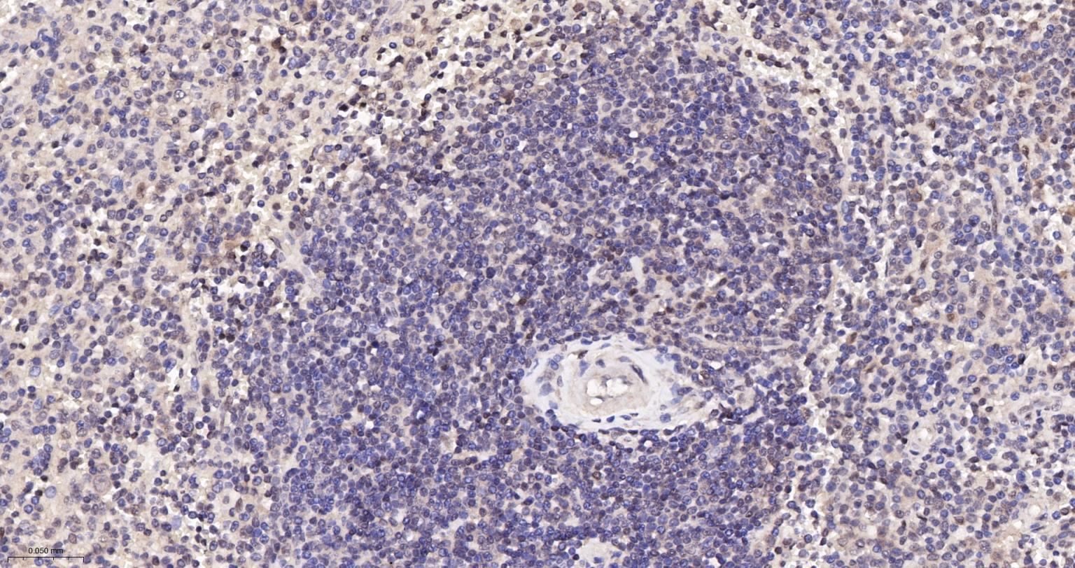 泛素蛋白(K48-linkage)重组兔单抗