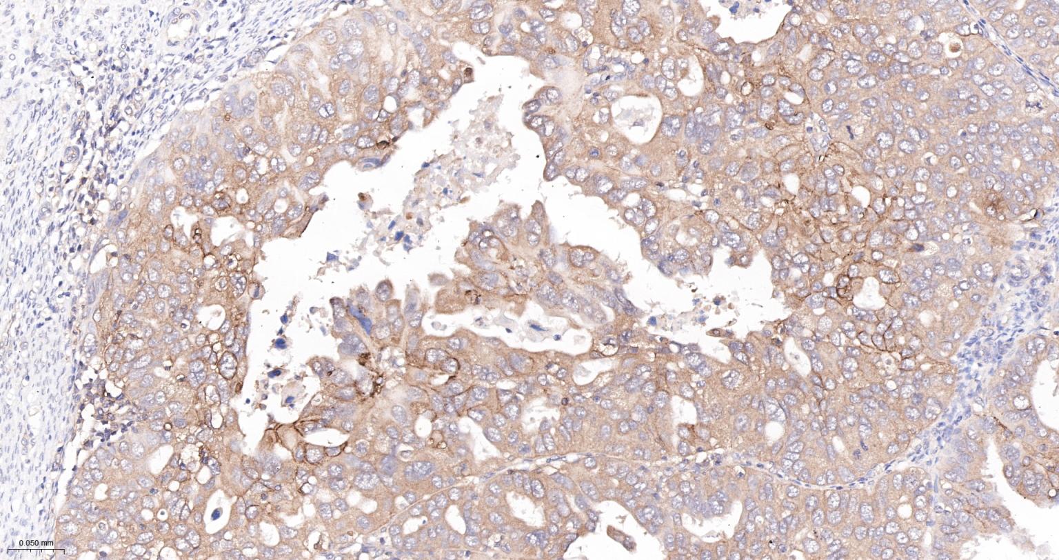 转铁蛋白受体（CD71）抗体