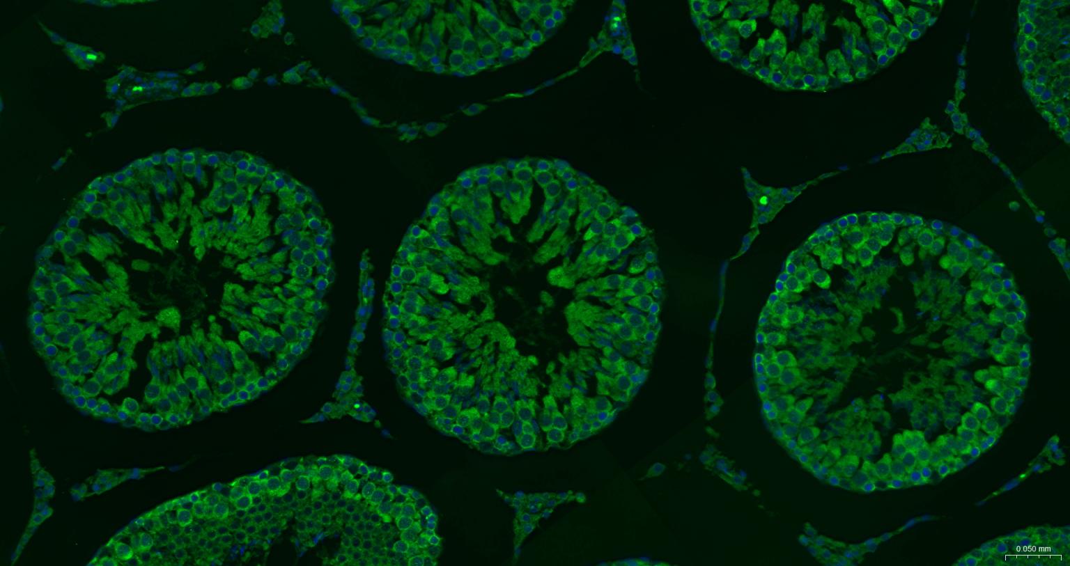 神经性舞蹈病蛋白重组兔单抗